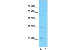 Host:  Rabbit  Target Name:  GPCR5A  Sample Type:  Jurkat  Lane A:  Primary Antibody  Lane B:  Primary Antibody + Blocking Peptide  Primary Antibody Concentration:  1ug/ml  Peptide Concentration:  5ug/ml  Lysate Quantity:  25ug/lane/lane  Gel Concentration:  0. (GPRC5A antibody  (C-Term))