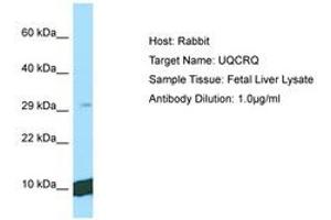 Image no. 1 for anti-Ubiquinol-Cytochrome C Reductase, Complex III Subunit VII, 9.5kDa (UQCRQ) (C-Term) antibody (ABIN6750145) (UQCRQ antibody  (C-Term))