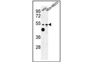 Western blot analysis of Tricellulin Antibody (C-term) in WiDr, MDA-MB231 cell line lysates (35ug/lane). (Tricellulin antibody  (C-Term))