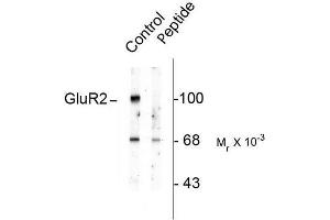 Image no. 1 for anti-Glutamate Receptor, Ionotropic, AMPA 2 (GRIA2) (pSer880) antibody (ABIN372656)