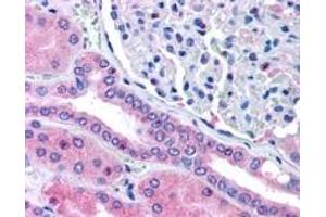 ABIN185439 (5µg/ml) staining of paraffin embedded Human Kidney. (RHPN2 antibody  (Internal Region))