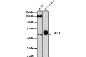 Western blot analysis of extracts of various cell lines, using MUL1 antibody (ABIN6133239, ABIN6144199, ABIN6144200 and ABIN6217001) at 1:3000 dilution. (MUL1 antibody  (AA 1-352))