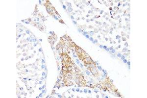Immunohistochemistry of paraffin-embedded Mouse testis leydig using Fibronectin Polyclonal Antibody at dilution of 1:100 (40x lens). (Fibronectin antibody)
