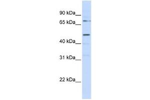Western Blotting (WB) image for anti-Kringle Containing Transmembrane Protein 1 (KREMEN1) antibody (ABIN2458904) (KREMEN1 antibody)