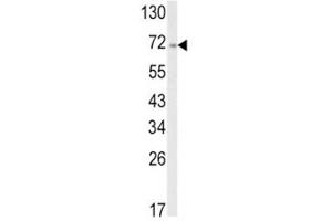 Western Blotting (WB) image for anti-Activating Transcription Factor 6 (ATF6) (AA 350-377) antibody (ABIN3028449)