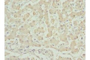 Immunohistochemistry of paraffin-embedded human liver tissue using ABIN7156239 at dilution of 1:100