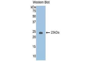 Western Blotting (WB) image for anti-serpin Peptidase Inhibitor, Clade A (Alpha-1 Antiproteinase, Antitrypsin), Member 6 (SERPINA6) (AA 25-195) antibody (ABIN1174369) (SERPINA6 antibody  (AA 25-195))