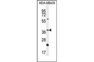 Western blot analysis of OR6V1 Antibody (C-term) in MDA-MB435 cell line lysates (35ug/lane).