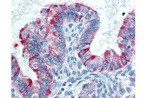 Anti-TNFRSF14 / CD270 antibody IHC of human uterus. (HVEM antibody  (AA 38-284))