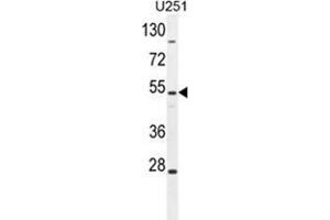 ZIK1 Antibody (Center) western blot analysis in U251 cell line lysates (35 µg/lane). (ZIK1 antibody  (Middle Region))