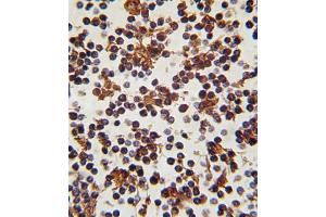 Formalin-fixed and paraffin-embedded human lymph tissue reacted with FOXP3 antibody (C-term), which was peroxidase-conjugated to the secondary antibody, followed by DAB staining. (FOXP3 antibody  (C-Term))