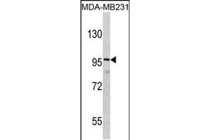 Western blot analysis of DLGAP1 Antibody in MDA-MB231 cell line lysates (35ug/lane) (DLGAP1 antibody  (N-Term))