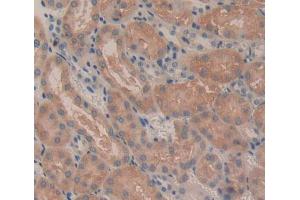 Used in DAB staining on fromalin fixed paraffin- embedded Kidney tissue (CROT antibody  (AA 410-612))
