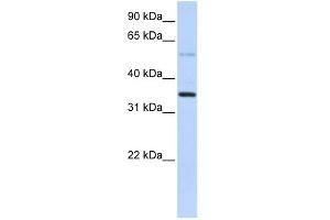 WB Suggested Anti-ANKRD9 Antibody Titration: 0. (ANKRD9 antibody  (Middle Region))