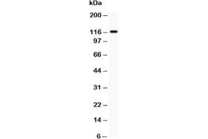 Western blot testing of c-Kit antibody and HEPG2 lysate (KIT antibody  (AA 26-285))