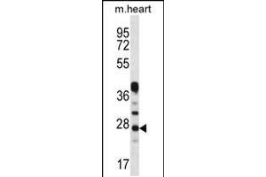 Western blot analysis in mouse heart tissue lysates (35ug/lane). (CRYBA1 antibody  (AA 104-133))