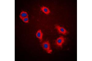 Immunofluorescence (IF) image for anti-Keratin 18 (KRT18) (N-Term), (pSer33) antibody (ABIN7299322)