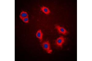 Immunofluorescent analysis of Cytokeratin 18 (pS33) staining in A431 cells. (Cytokeratin 18 antibody  (N-Term, pSer33))