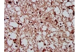 IHC image of ABIN7146885 diluted at 1:300 and staining in paraffin-embedded human brain tissue performed on a Leica BondTM system. (CSNK2A1/CK II alpha antibody  (AA 1-391))