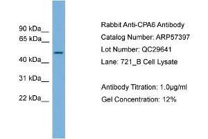 WB Suggested Anti-CPA6  Antibody Titration: 0. (CPA6 antibody  (Middle Region))
