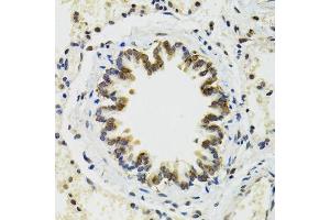 Immunohistochemistry of paraffin-embedded rat lung using RUVBL2 antibody. (RUVBL2 antibody  (AA 1-463))