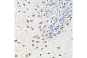 Immunohistochemistry (Paraffin-embedded Sections) (IHC (p)) image for anti-ELAV (Embryonic Lethal, Abnormal Vision, Drosophila)-Like 1 (Hu Antigen R) (ELAVL1) (AA 1-100) antibody (ABIN6140112)