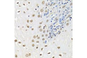 Immunohistochemistry of paraffin-embedded human esophagus using ELAVL1 antibody. (ELAVL1 antibody  (AA 1-100))