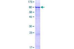 ST7 Protein (AA 1-547) (GST tag)