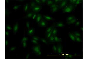 Immunofluorescence of monoclonal antibody to MAK on HeLa cell. (MAK antibody  (AA 358-457))