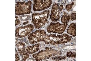 Immunohistochemical staining (Formalin-fixed paraffin-embedded sections) of human kidney using DUSP10 polyclonal antibody  shows strong cytoplasmic positivity with granular pattern in renal tubules. (DUSP10 antibody  (AA 180-291))
