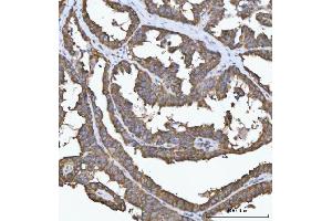 IHC analysis of FADS1 using anti-FADS1 antibody (ABIN7599175). (FADS1 antibody  (AA 1-257))