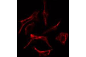 ABIN6269254 staining Hela cells by IF/ICC. (ZAP70 antibody  (Internal Region))
