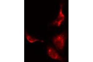 ABIN6275550 staining  HuvEc cells by IF/ICC. (PPP2R3C antibody  (C-Term))