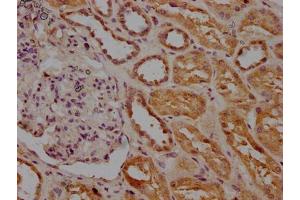 IHC image of ABIN7156340 diluted at 1:200 and staining in paraffin-embedded human kidney tissue performed on a Leica BondTM system. (INSRR antibody  (AA 747-921))