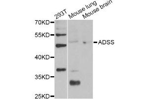 Western blot analysis of extracts of various cell lines, using ADSS Antibody (ABIN6292806) at 1:1000 dilution. (ADSS antibody)