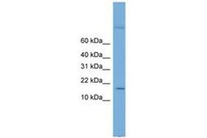 Image no. 1 for anti-Cystatin 8 (CST8) (AA 35-84) antibody (ABIN6743620)