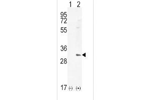 Western blot analysis of HMOX1 (arrow) using rabbit polyclonal HMOX1 Antibody (Center) (ABIN655187 and ABIN2844803). (HMOX1 antibody  (AA 177-204))