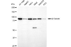 Western blotting analysis using β catenin antibody (ABIN7797936). (Recombinant beta Catenin antibody)