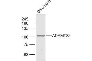 Mouse Cerebrum lysates probed with ADAMTS4 Polyclonal Antibody, Unconjugated  at 1:1000 dilution and 4˚C overnight incubation. (ADAMTS4 antibody  (AA 501-839))