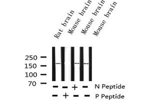 Western blot analysis of Phospho-Ret (Tyr1062) expression in various lysates (Ret Proto-Oncogene antibody  (pTyr1062))