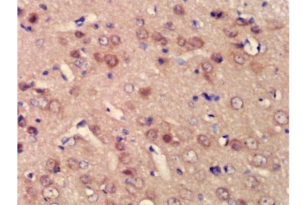 BPTF antibody  (AA 2801-3046)