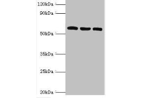 Western blot All lanes: Thioredoxin reductase 2, mitochondrial antibody at 6 μg/mL Lane 1: Mouse liver tissue Lane 2: Mouse gonad tissue Lane 3: Hela whole cell lysate Secondary Goat polyclonal to rabbit IgG at 1/10000 dilution Predicted band size: 57, 54, 47, 31 kDa Observed band size: 57 kDa (TXNRD2 antibody  (AA 100-310))