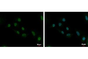 ICC/IF Image UBE2C antibody [N1C3] detects UBE2C protein at cytoplasm and nucleus by immunofluorescent analysis. (UBE2C antibody)