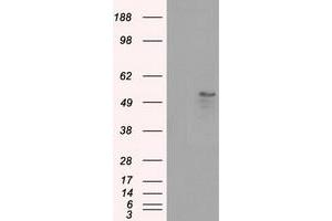 Western Blotting (WB) image for anti-Solute Carrier Family 2 (Facilitated Glucose/fructose Transporter), Member 5 (SLC2A5) antibody (ABIN1498475) (SLC2A5 antibody)