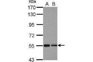 WB Image Sample (30 ug of whole cell lysate) A: U87-MG B: SK-N-SH 7. (KBTBD4 antibody  (Center))