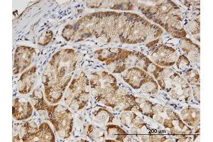 Immunoperoxidase of monoclonal antibody to PVRL3 on formalin-fixed paraffin-embedded human stomach. (nectin-3 antibody  (AA 59-166))