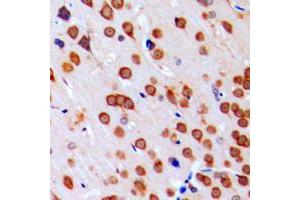 Immunohistochemical analysis of JAB1 staining in human brain formalin fixed paraffin embedded tissue section. (COPS5 antibody  (Center))