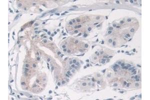 Immunohistochemistry (IHC) image for anti-Transient Receptor Potential Cation Channel, Subfamily C, Member 6 (TRPC6) (AA 1-192) antibody (ABIN7441304)
