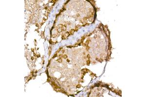 Immunohistochemistry of paraffin-embedded human testis using NY-ESO-1 Rabbit pAb (ABIN6129965, ABIN6139172, ABIN6139173 and ABIN6225112) at dilution of 1:150 (40x lens). (CTAG1B antibody  (AA 1-180))