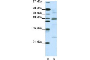 WB Suggested Anti-NFKBIB Antibody Titration:  5. (NFKBIB antibody  (C-Term))
